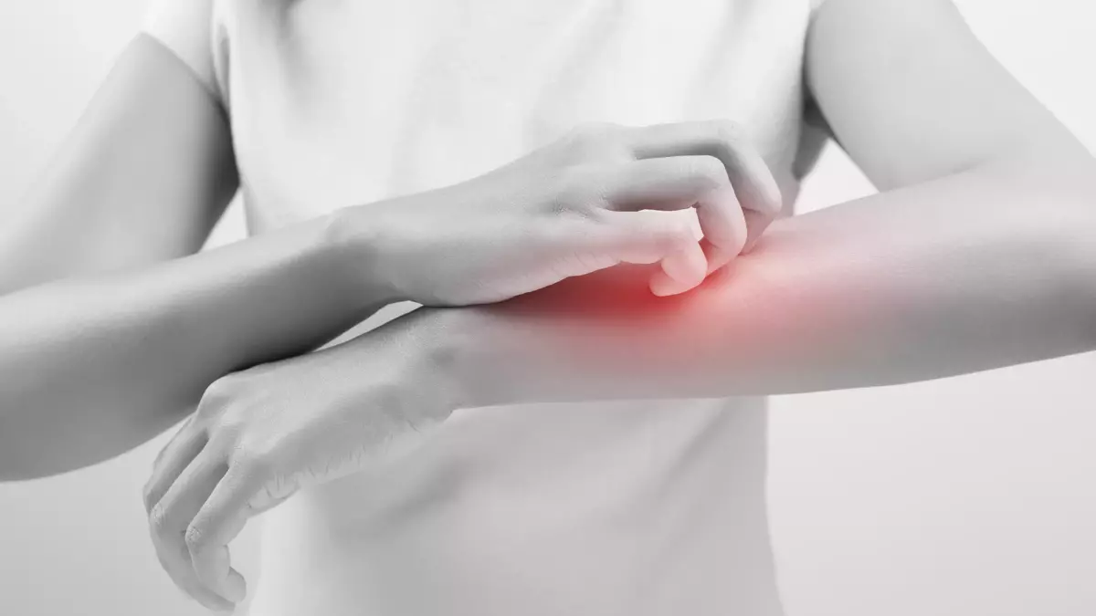 TEİS'ten Uyuz Tedavisi Önerisi: SGK Karşılasın