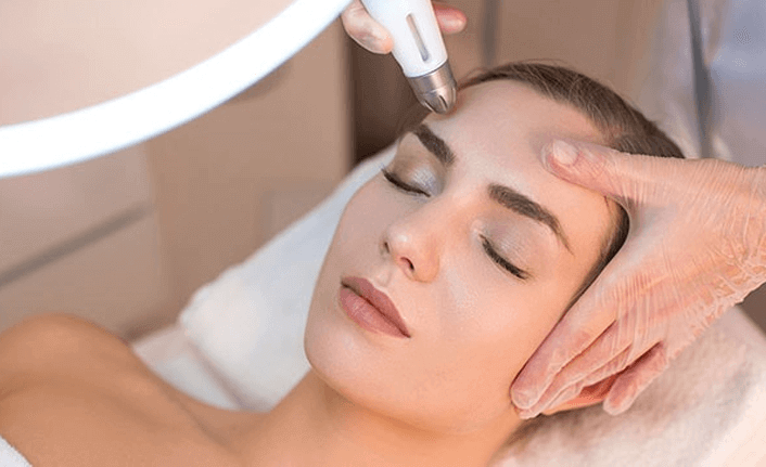 Akne Tedavisinde Altın İğne Yöntemi